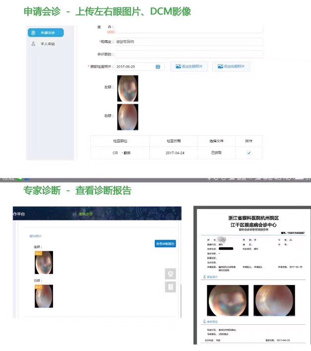 江干区眼底病会诊中心平台